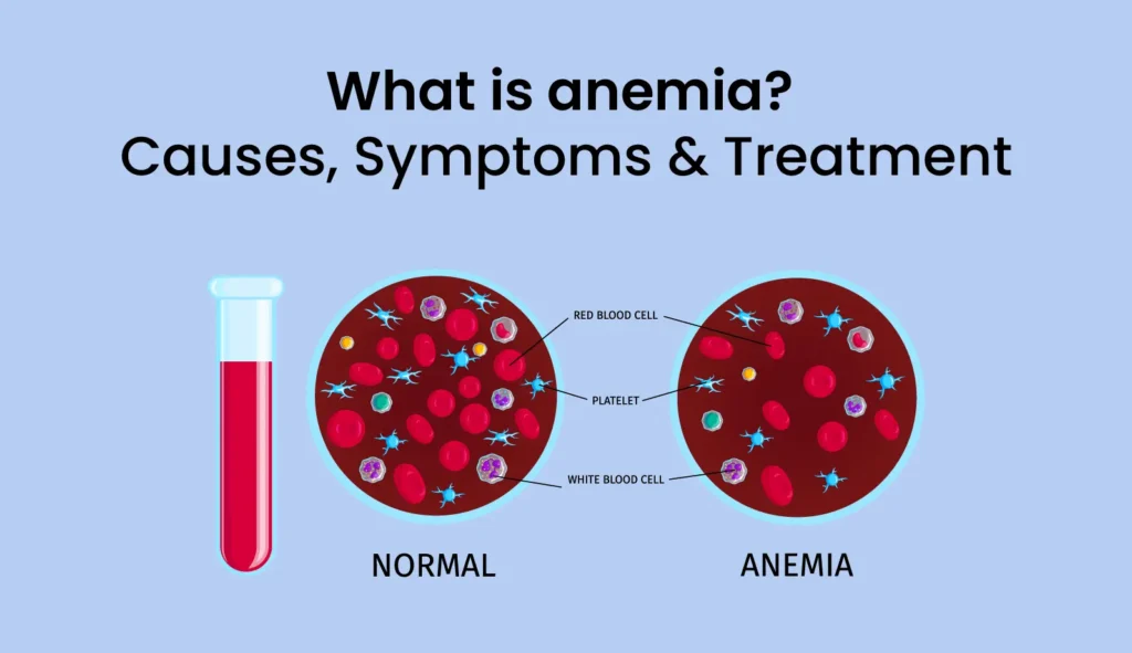 Anemia