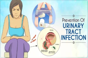 urinary track infections